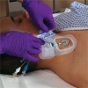 MEDICAL ACTION® - Tegaderm® - Dressing Change Tray - 61249 - In Use